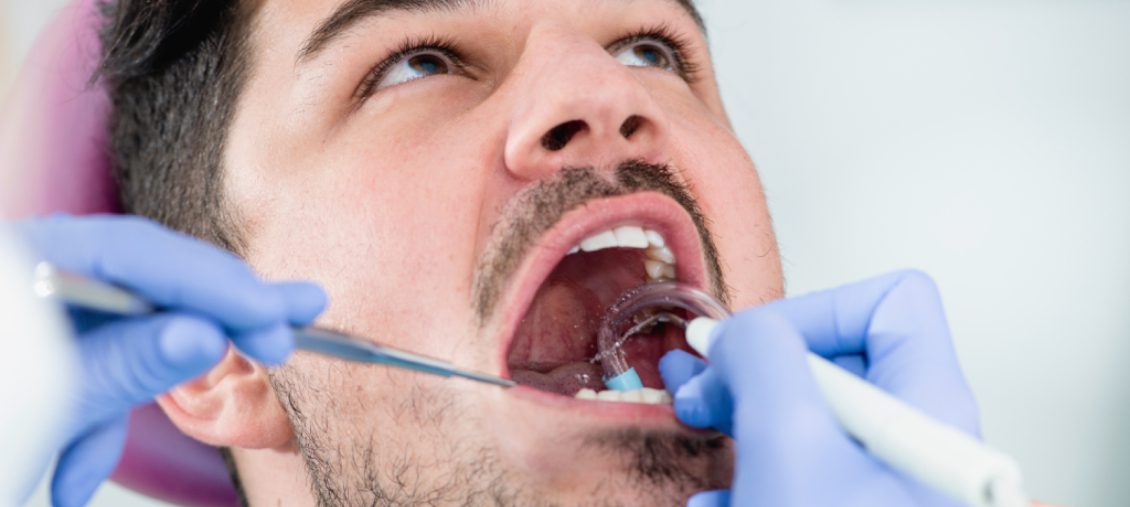 Periodontal Cleaning 1024x430 1 - Stevenson Family Dentistry -